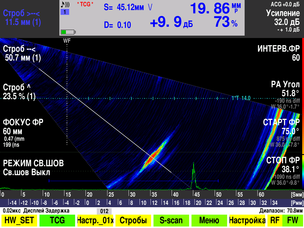 Визуализация DIO 1000 PA